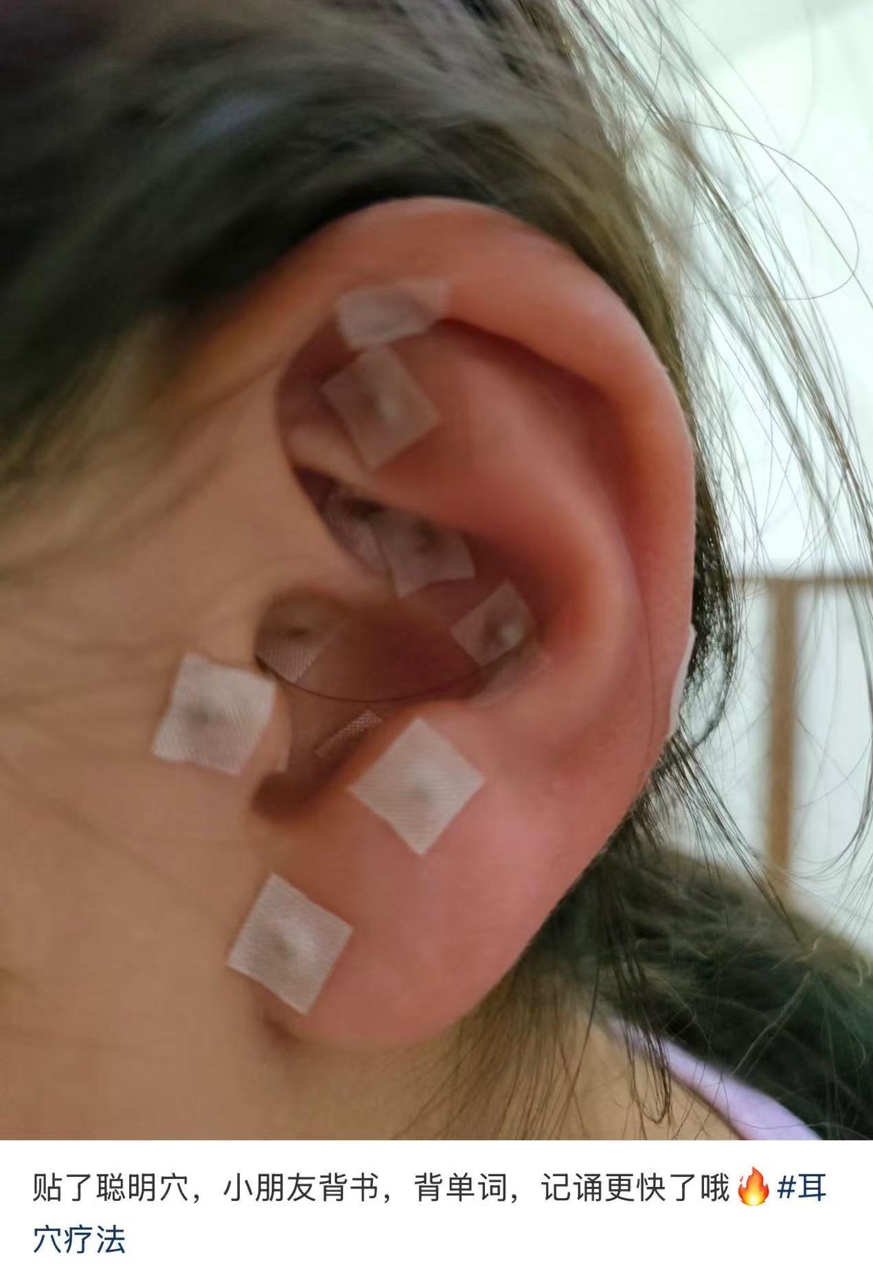 这是聪明贴，贴完能提升孩子智商和记忆力？朋友家孩子学习成绩不好，朋友刚刚买了