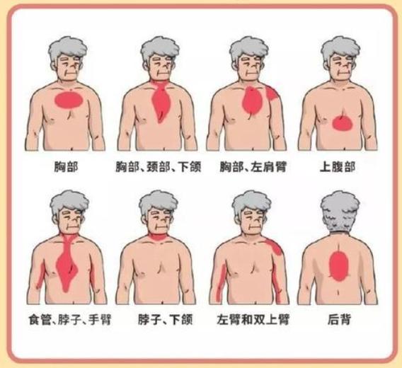 心梗的12种预兆，请牢记！1. 头晕2. 脐周疼痛3. 脚底疼痛4. 睁