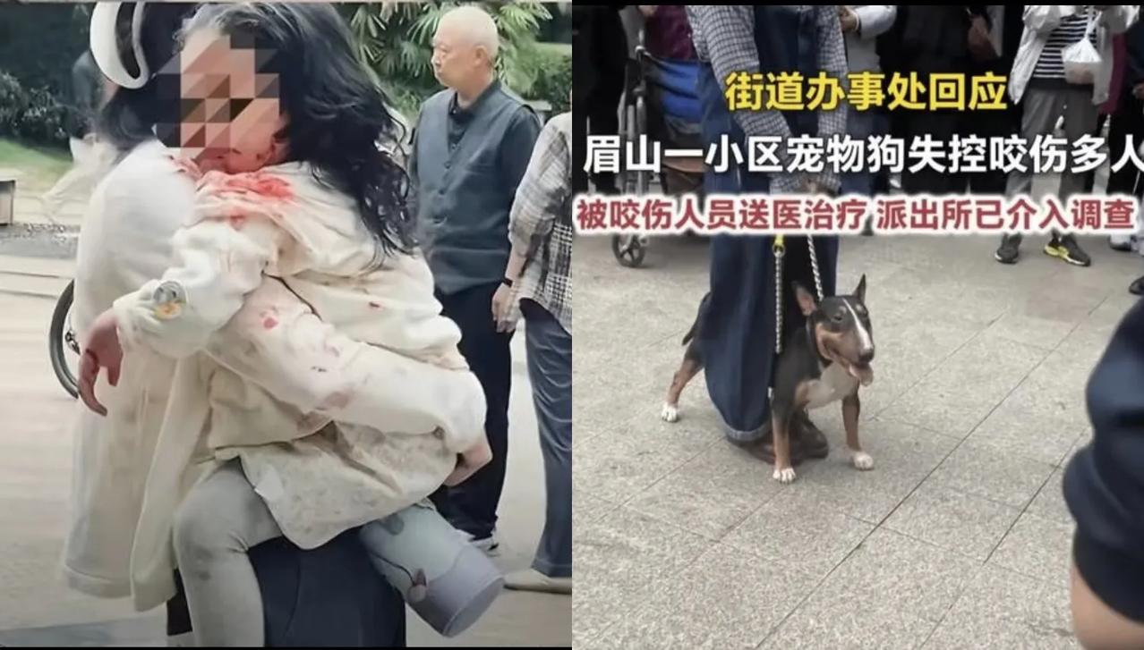 看到四川女童被恶犬咬伤我立马做了三件事：第一件事，赶紧打开购物软件，买几瓶