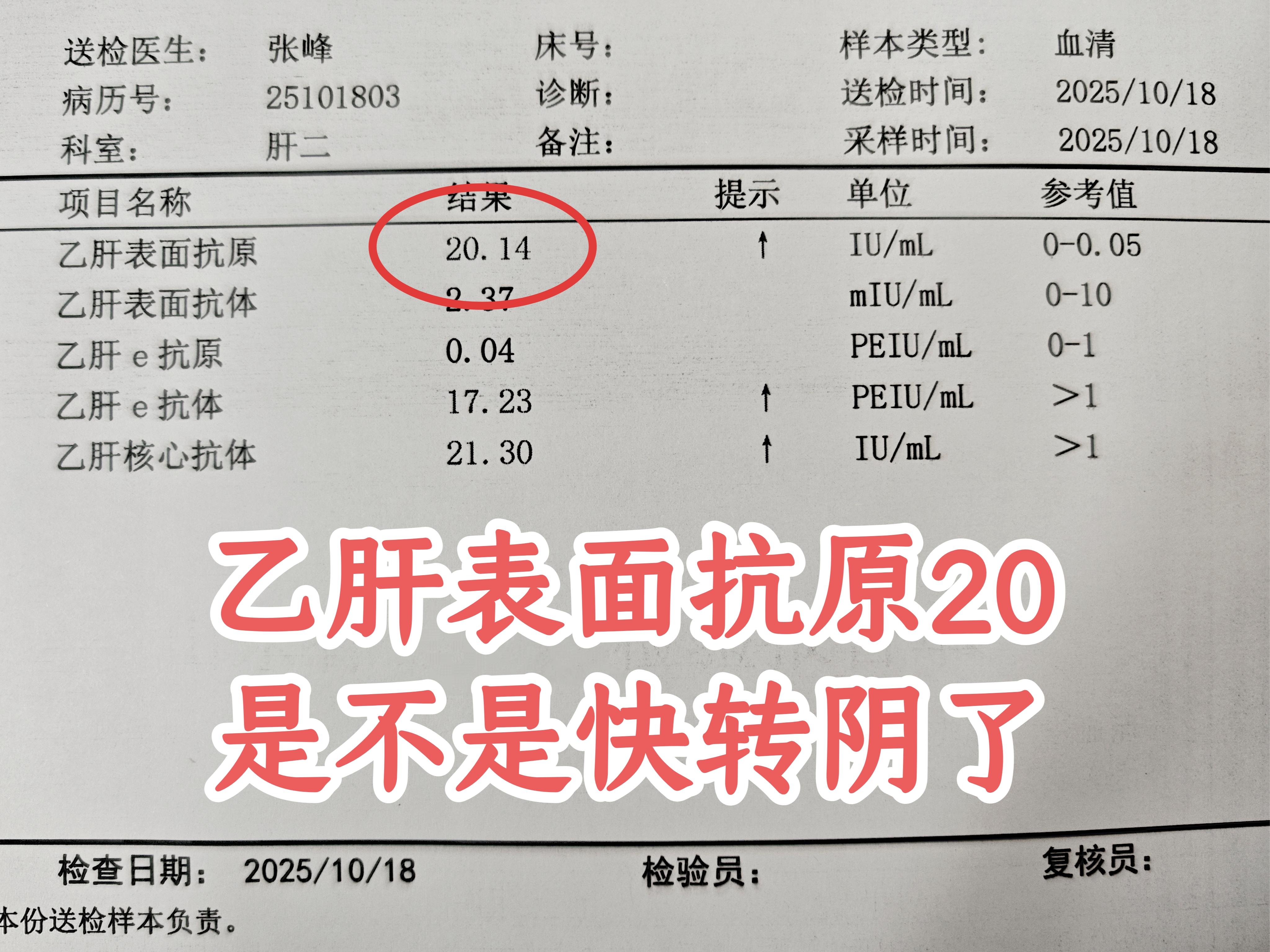 “教授，我表面抗原仅剩下20了，是不是乙肝快好了？”这是专家会诊时，一...