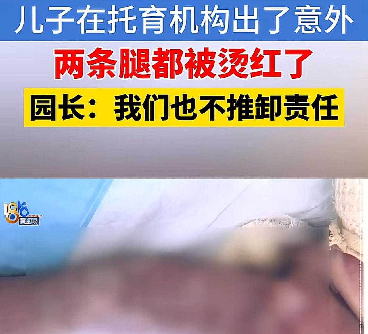 浙江杭州，女子将一岁的儿子送去托育园体验一周的半托班。万万想不到，没几天，儿子就