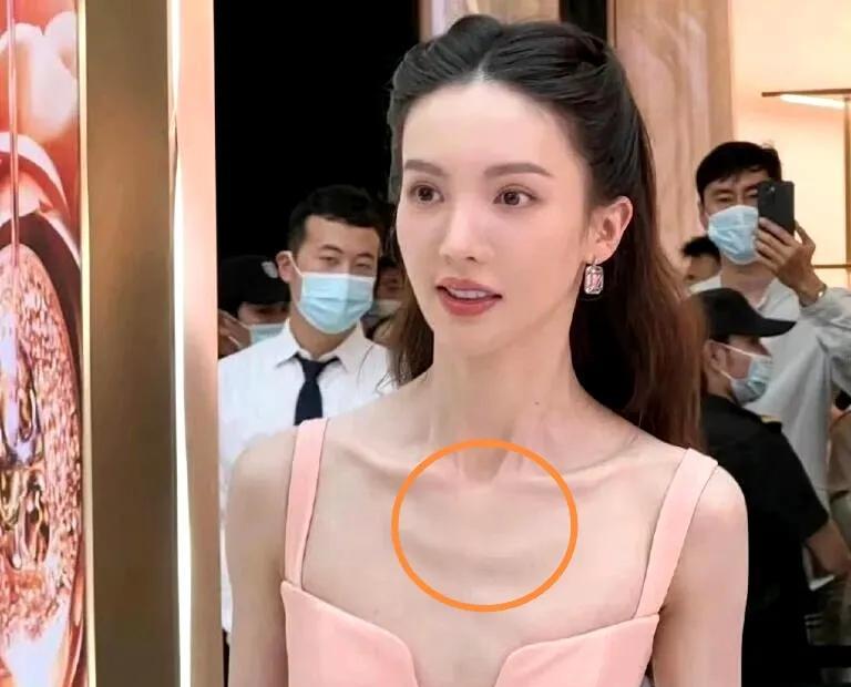 金晨！醒醒吧！别怪我说话难听，如果我是你，我第一件事情就是停止减肥。毕竟你