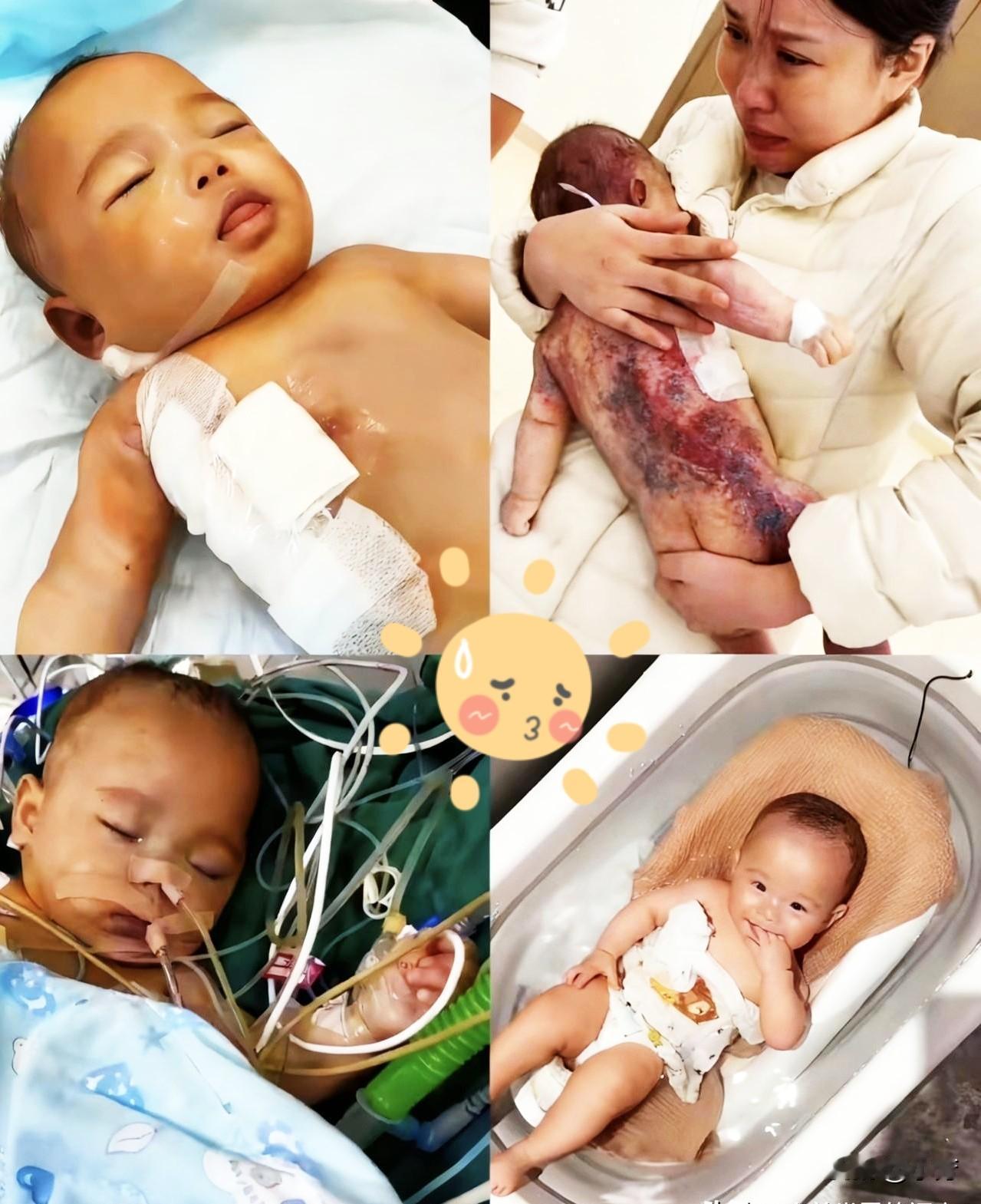 国家终于出手了浙江那个五个月大的宝宝真的太让人心疼了本来是个两小时就能结束