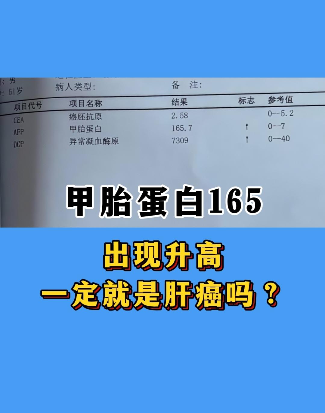 上午我看评论区，有位山东淄博的患者发来检查单，甲胎蛋白165，问是不是...