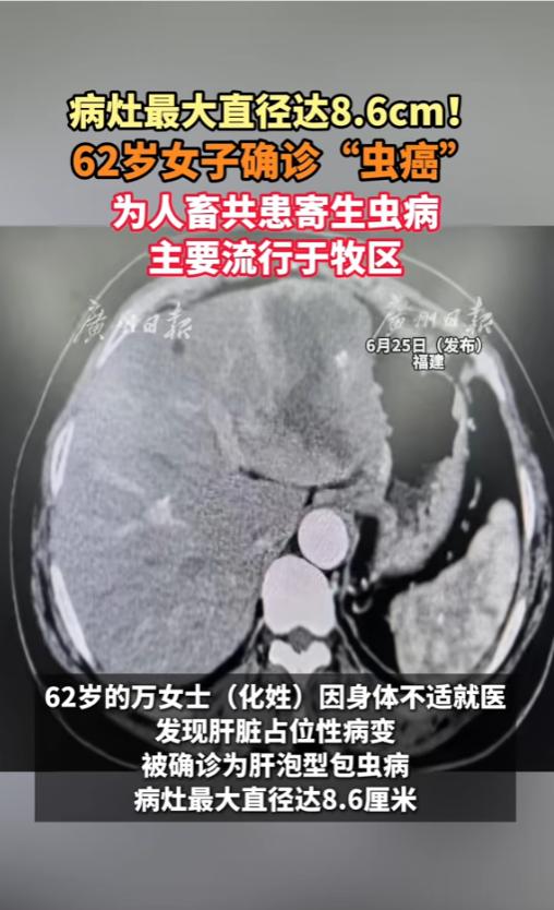 “人和宠物还是要分清楚！”6月25日报道，福建，一位62岁的女子身体不适到医院检