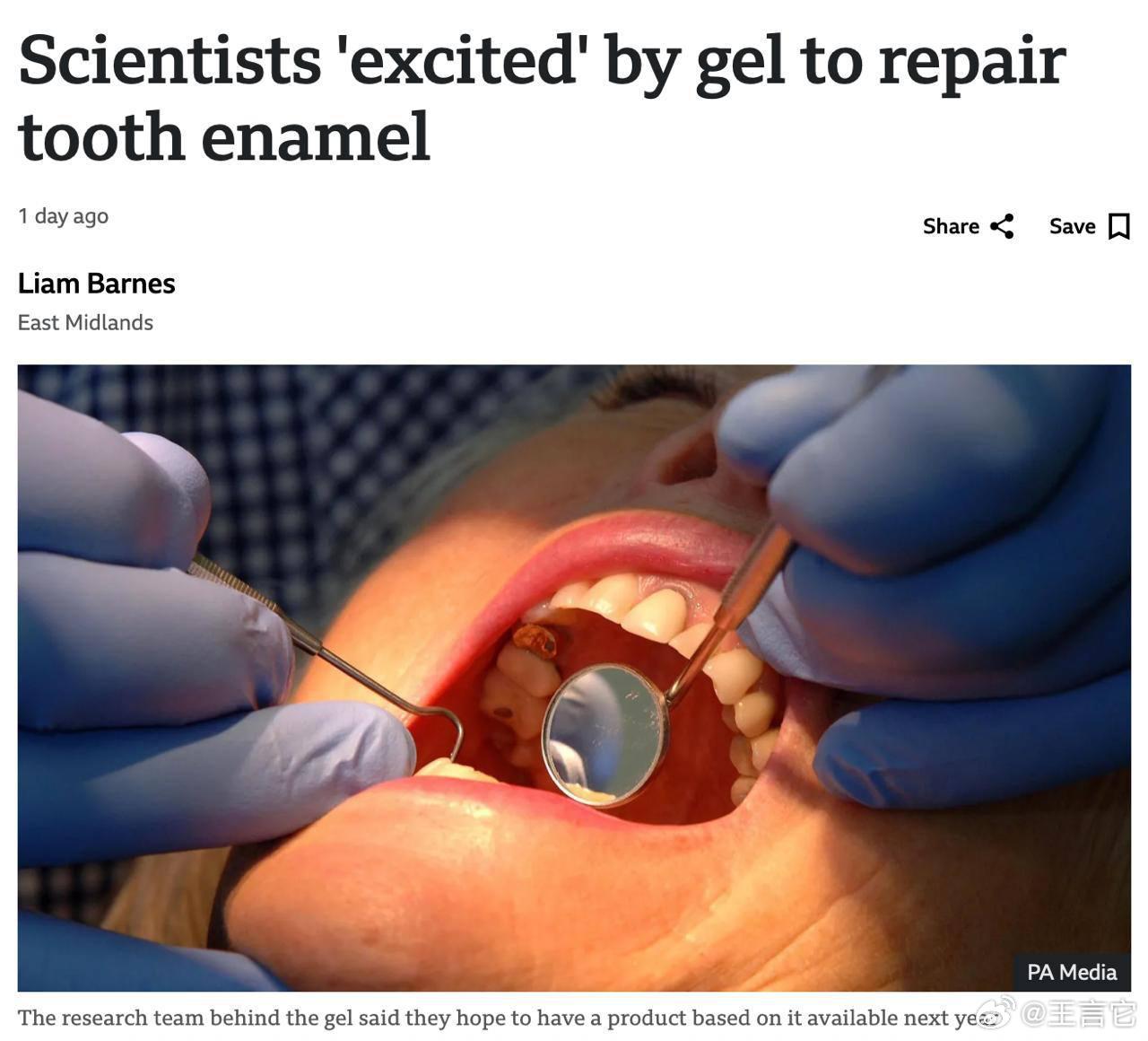 🦷蛀牙可能很快就会成为历史！科学家们研制出一种可以修复牙釉质的凝胶。