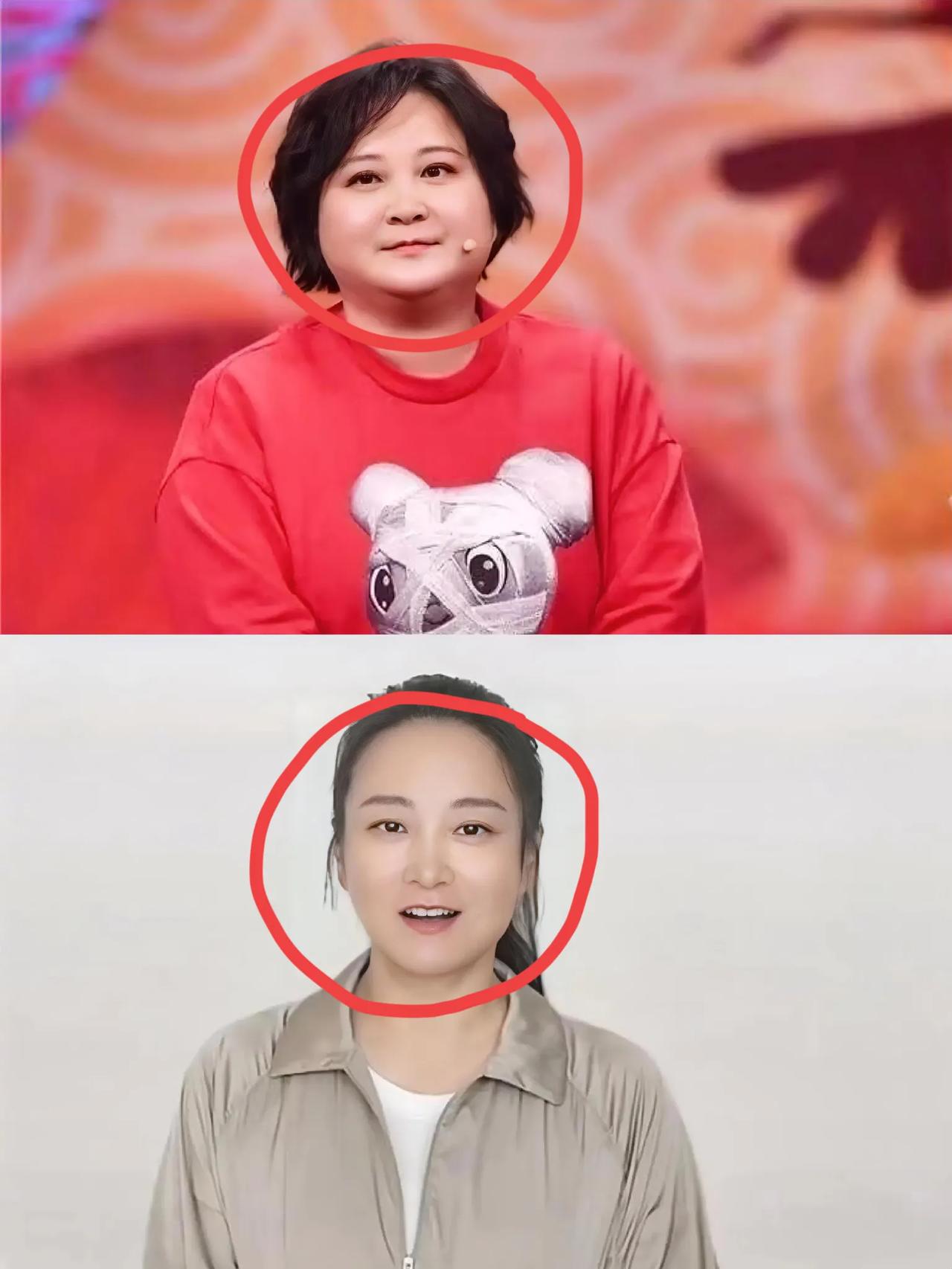 终于知道为什么贾玲减重100斤不仅没有掉头发，还越来越漂亮了不是因为医美