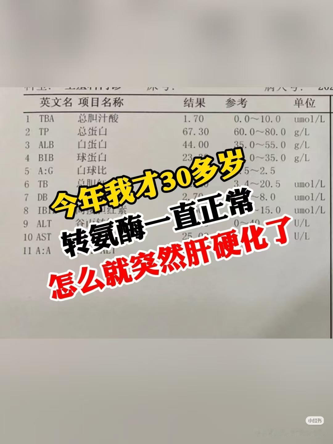 转氨酶正常，为何突然确诊肝硬化？刚拿到这位患者的复查报告时，我也很纠结，年仅3