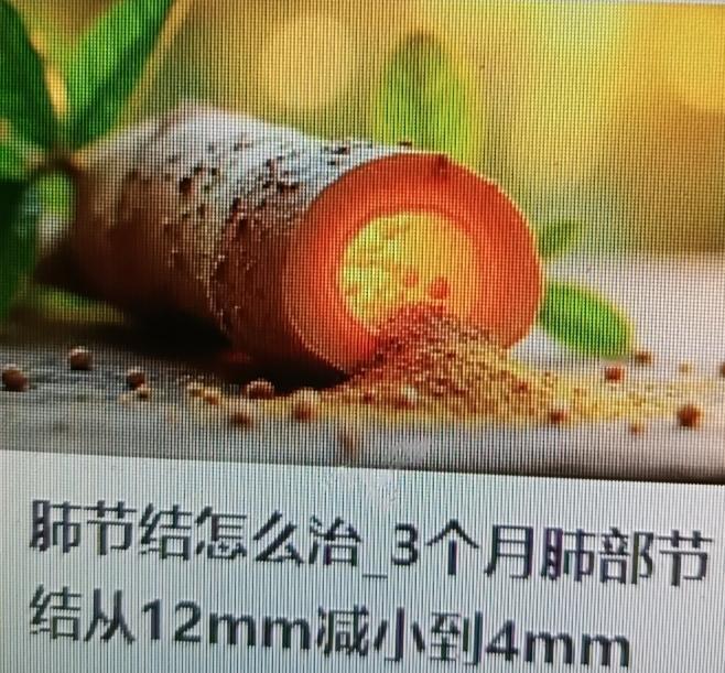 肺结节怎么治？三个月肺部结节从12mm减少到4mm