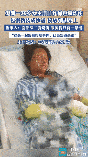 湖南29岁女主播在家准备拆快递时，只是看了一眼包裹还没来的及拆开就发生了爆炸，导