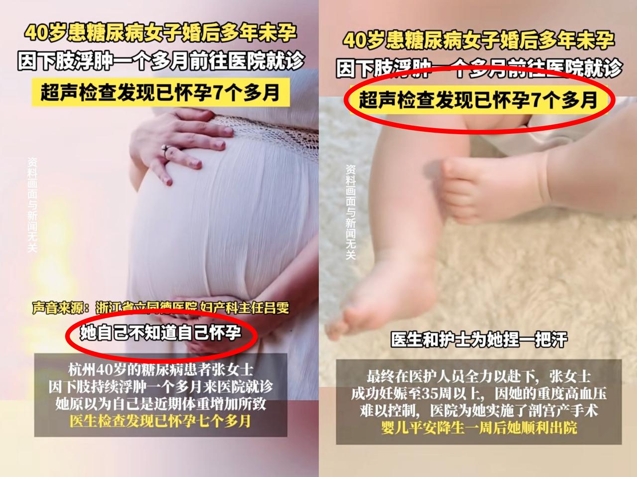 肚子大了以为是发福，心也太大了！杭州一40岁女子怀孕7个多月自己竟完全没察觉，