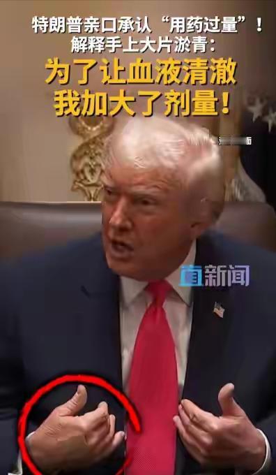 特朗普身体出状况了，健康堪忧，不知是否可以撑到1月20号？近来，79岁的特朗