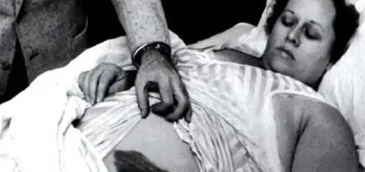 1954年，国外一女子正在睡觉中，突然感觉腹部和大腿被什么东西蹭着了一样，疼痛难