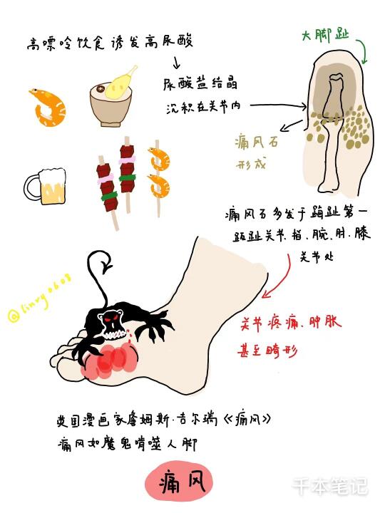 🔥痛风年轻化！2024最新饮食指南