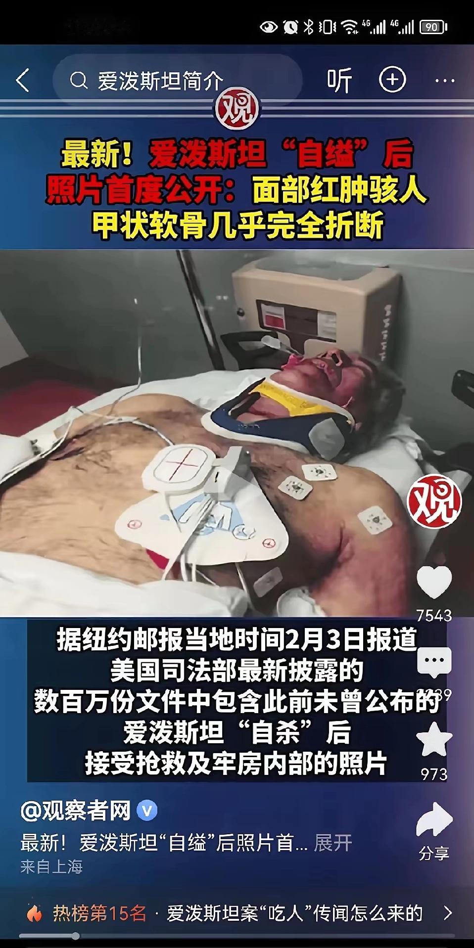 这爱泼斯坦死得也太离谱了，明眼人一眼就能看穿。那照片里脖子上的勒痕根本不对劲，要