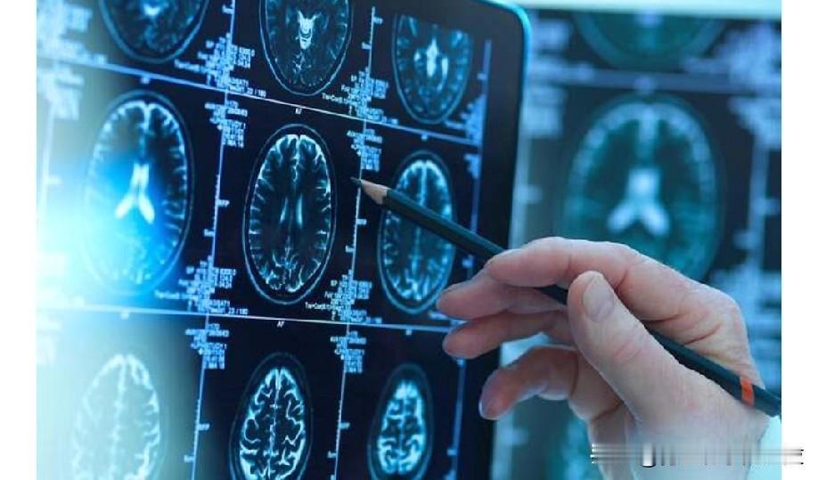 想要一个年轻的大脑?保持肌肉，摆脱脂肪。一项新的研究表明，健康的身体和肌肉也