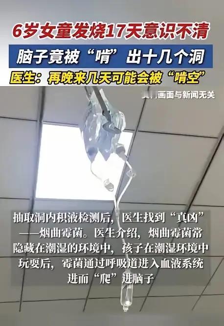 河南小女孩烟曲霉菌感染，脑部十几个洞，发烧17天才确诊！高压氧治疗住ICU2