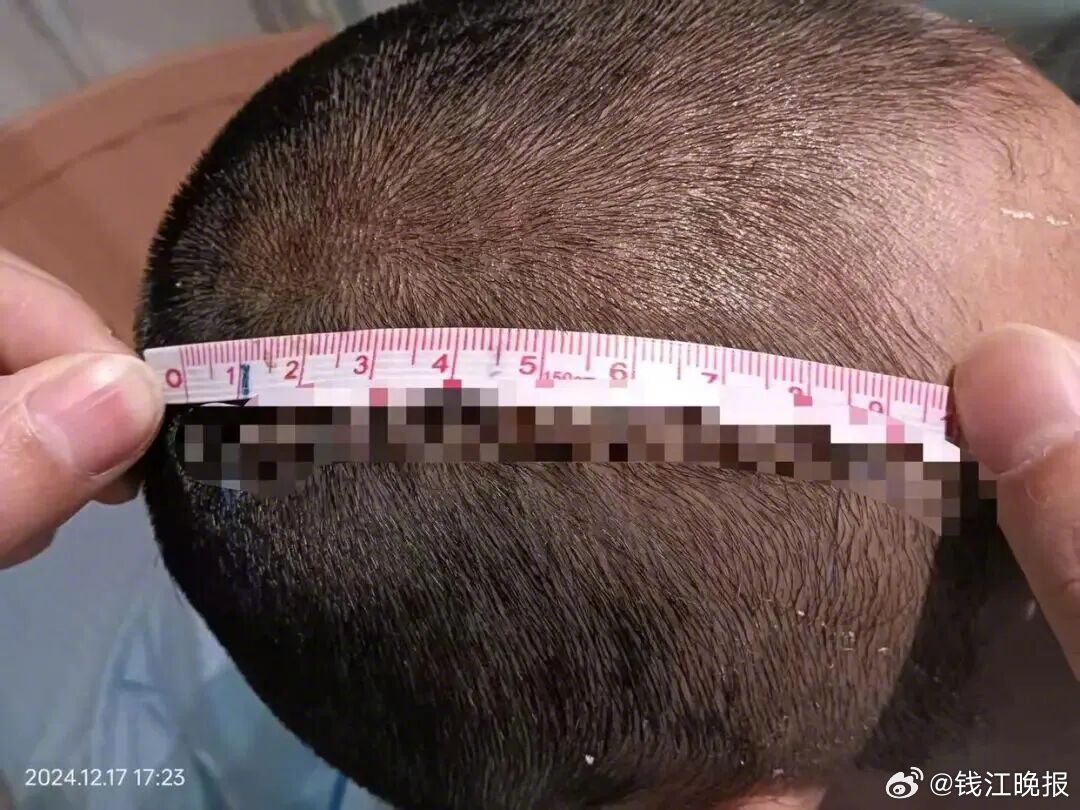 【#爷爷将孙女6岁同学砍成重伤#】2024年12月，上海松江区古松学校一年级女生