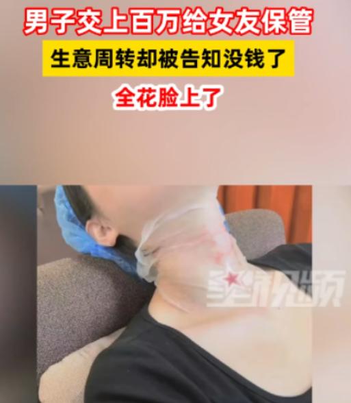 重庆，一男子将130万余元全都交给漂亮女友保管，可女友却在闺蜜的推荐下去做了医美