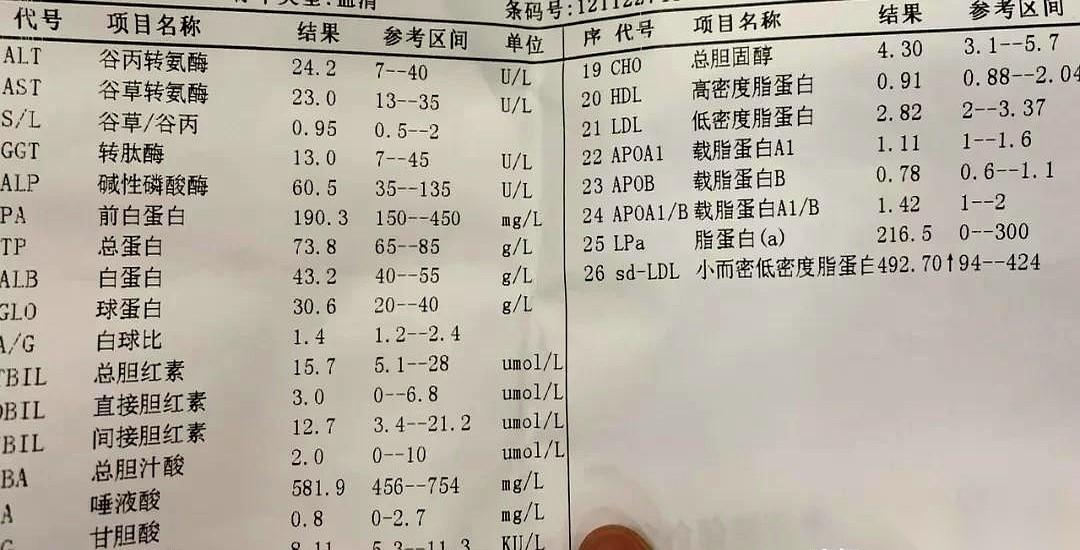 右边肋骨就胀了那么一下，老李连银行卡密码都想好要怎么交接给老婆了。十多年的老乙