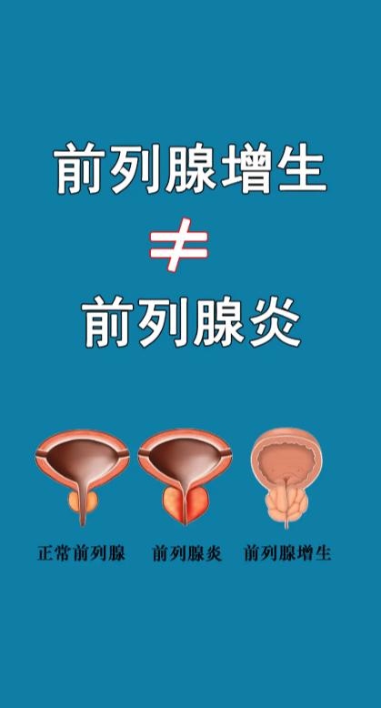 健康科普：前列腺增生和前列腺炎不是一回事