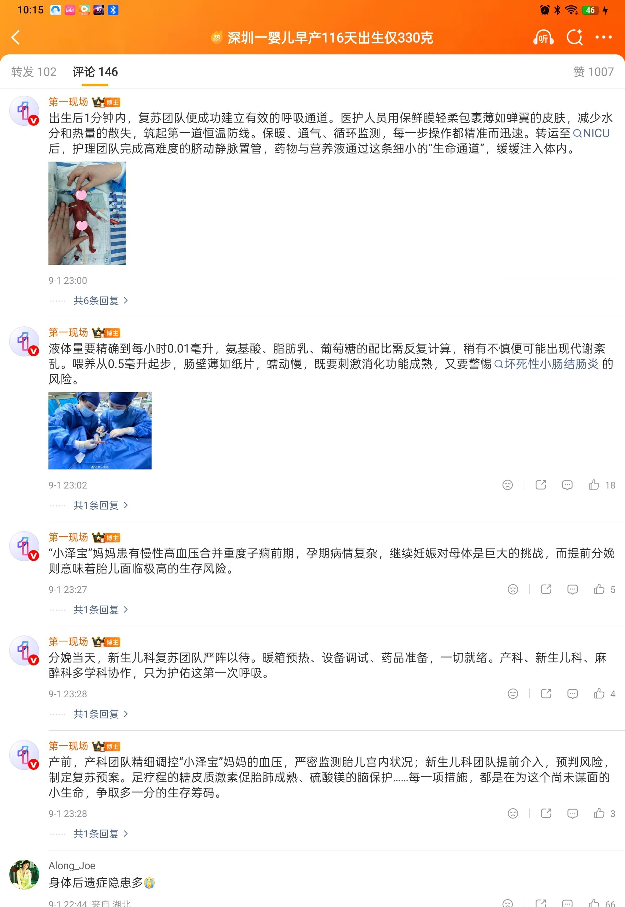 孕妇高血压婴儿提前116天出生仅330克看完小泽宝的故事，忍不住眼眶湿润。很难想