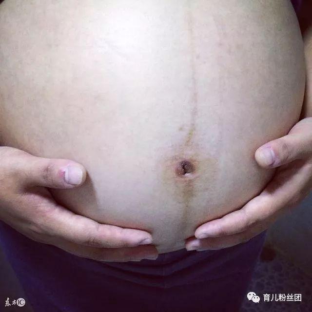 90后孕妈的伟大母爱, 脑死亡1个月, 双胞胎顺利出生后停止呼吸!