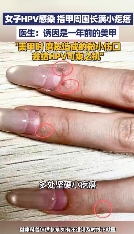 5月8日，杭州女子做美甲进医院的话题突然冲上热搜！起因是一位网友在