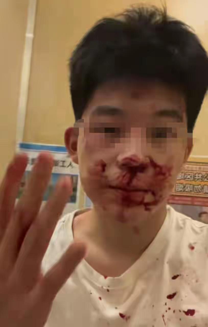 [吃瓜]山西运城“冒充警察打人”的事，最后在“媒体关注”下，刑事立案（轻伤二