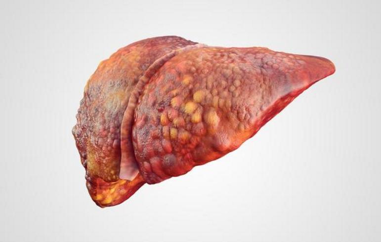 12月第一个好消息，肝硬化患者请听好，即使到了代偿期也不用怕12月的第一天