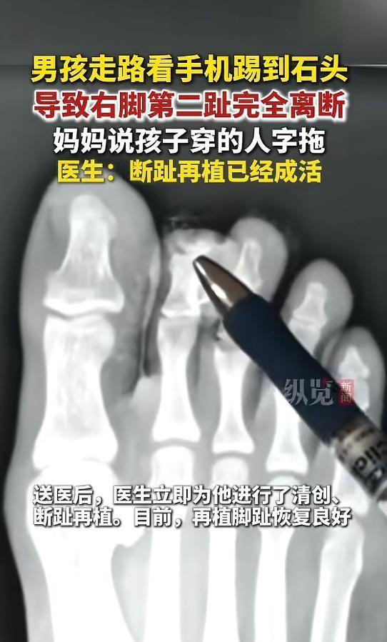 “太吓人了！”5月11日光明网等媒体报道，广东广州一16岁小伙，因穿着人字拖并低