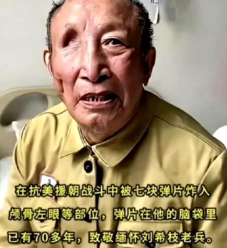 7块弹片炸入颅骨、左眼等部位，并且在脑袋里留存了70多年，抗美援朝的战场上，刘希