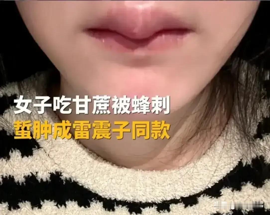 杭州一公园，一女子正惬意地吃着甘蔗，突然舌尖一阵剧痛。她掏出镜子一照，眼眶瞬间红