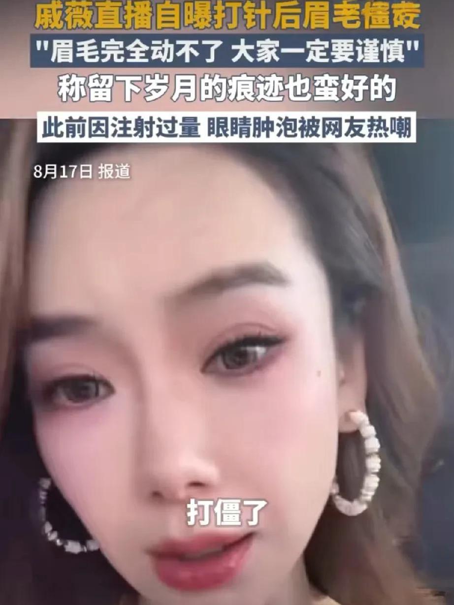 戚薇一句话“打”了多少女星的脸！她大方承认自己“吊梢眼”是因为打肉毒过量，眉毛完