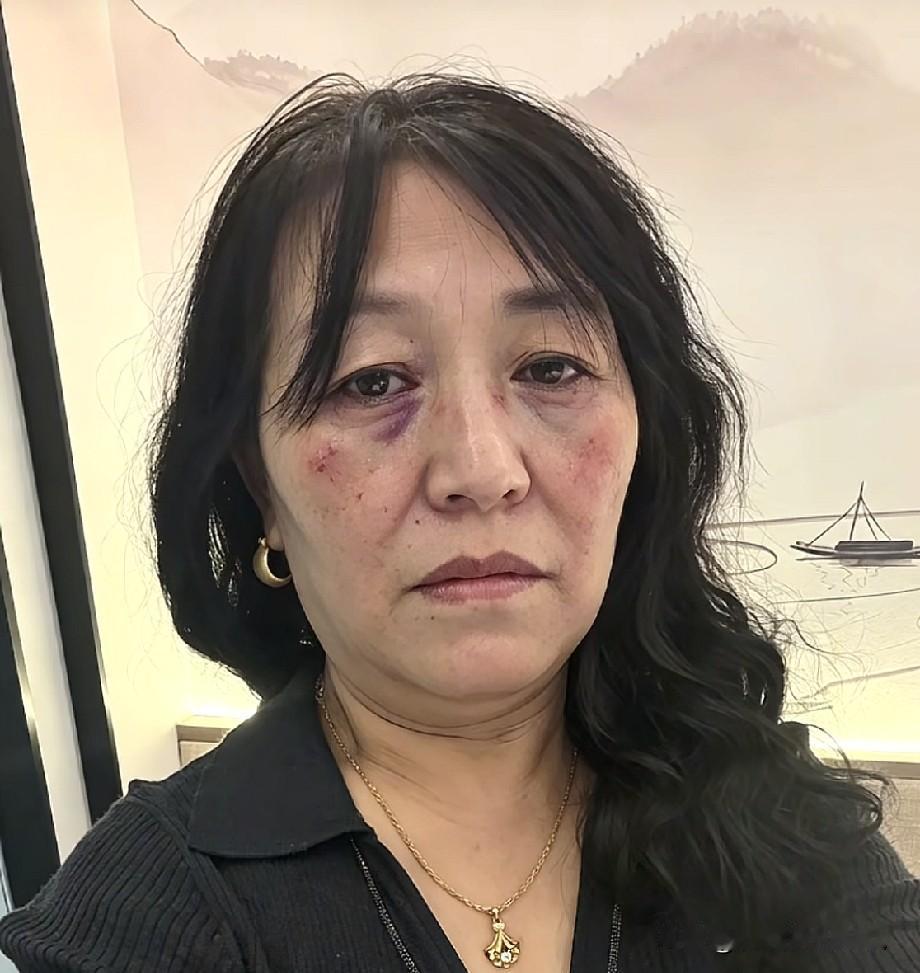 小故事！这王金刚从前都是仰着下巴壳说话，现在她有好几天已经没有露头