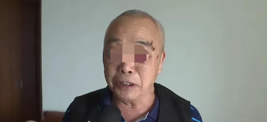 这么好心？重庆，一70多岁大爷正遛弯时，一陌生男子告诉大爷，如果现在不把眼袋割了