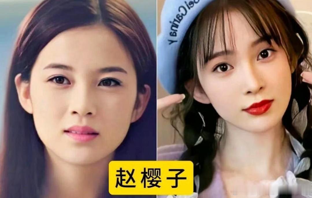赵樱子是不是又医美了？她的颜值变化确实挺明显的。虽然每个阶段都很漂亮，但以前的她