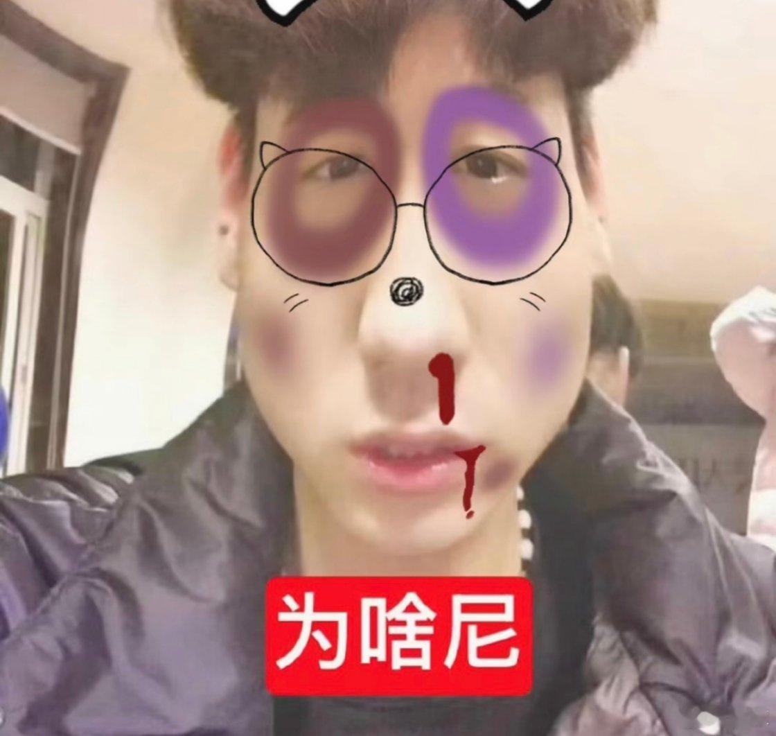 卧槽我就这一个田雷你们别把他给我玩死了​​​
