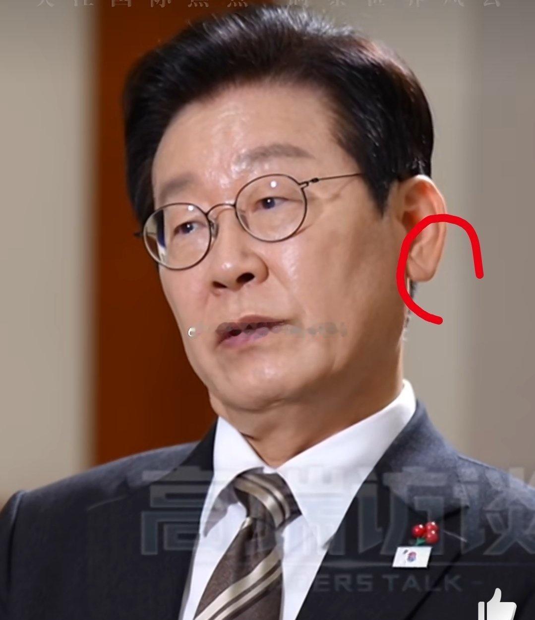 你知道吗，耳垂上的皱纹不仅仅是aging的标志，它可能还暗藏心脏病的重大信号