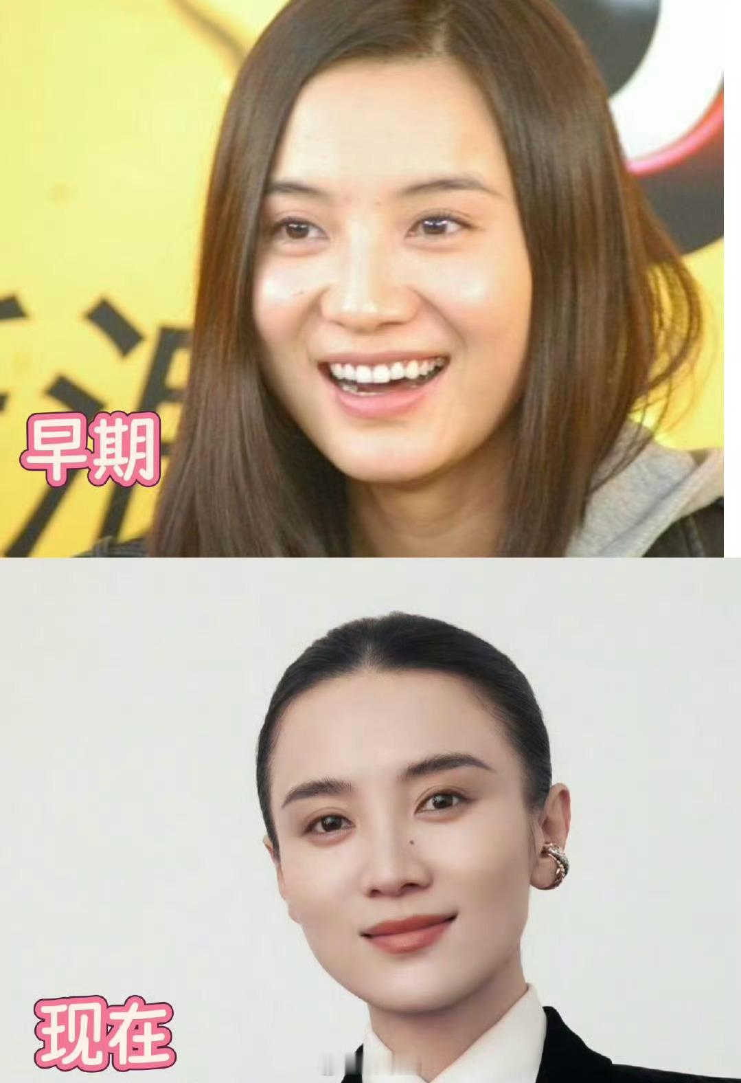宋佳面相变化宋佳不是一直都很美吗，早期有一股清纯小白花的味道，外表纤弱，实际内心