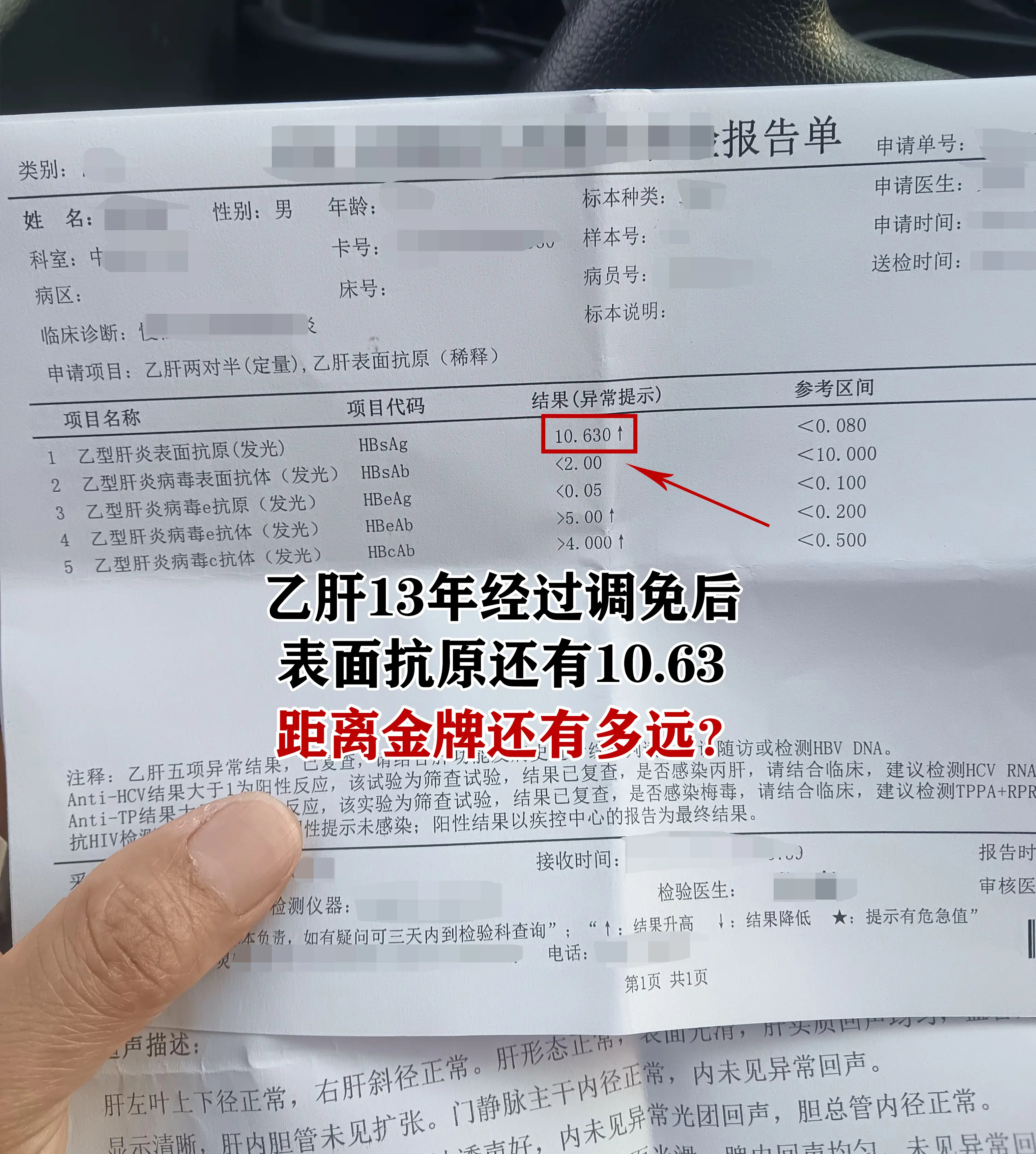 乙肝抗病毒整整13年。病毒早已转阴，肝功也一直比较稳定，后面又配合中西...
