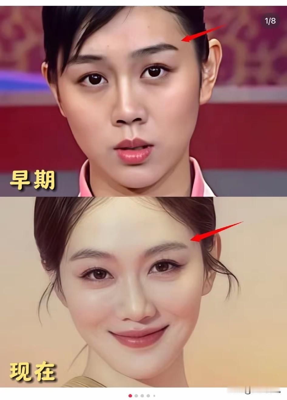 姜妍没有整之前真的不好看典型的东北大妞，所以，她一直不瘟不火！她现在的美