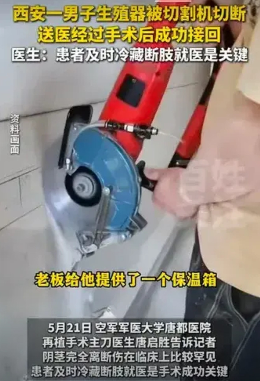 安全意识薄弱，但医学常识绝对杠杠滴，男子成功保住“命根子”！天下之大无奇不有！