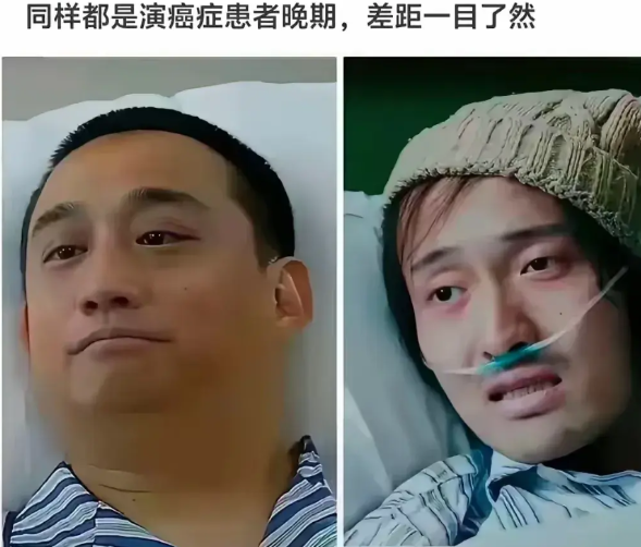 这黄磊是不是以为涂两个黑眼圈就是癌症病人了，就显得病入膏肓了？就这胖头鱼的脑袋