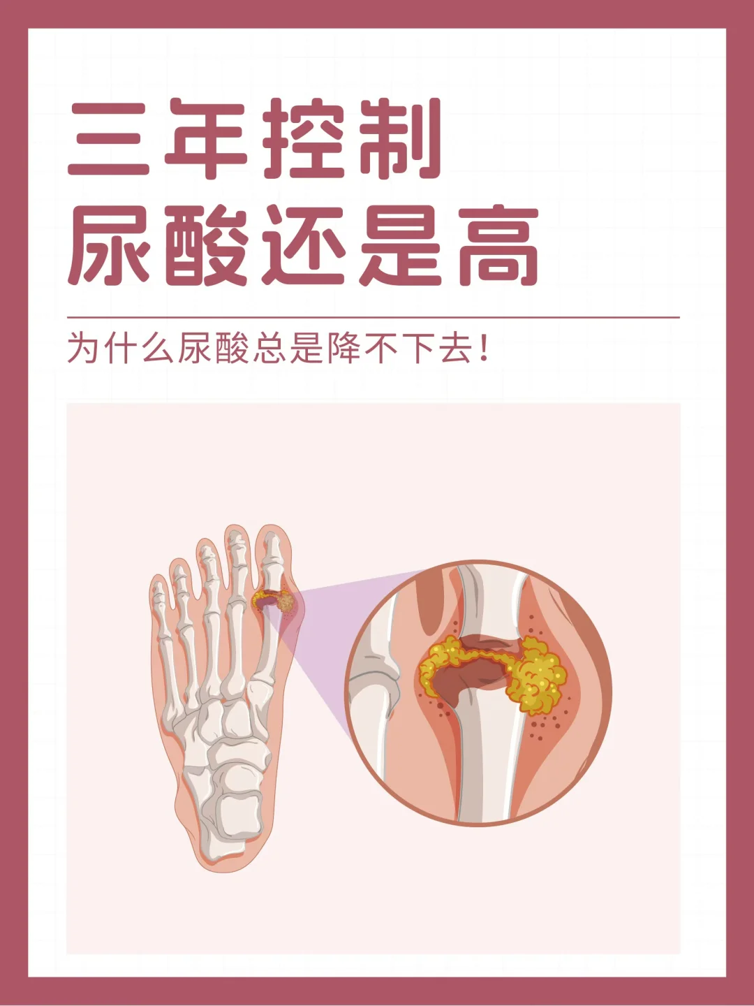 三年控制，为啥尿酸还是高！
