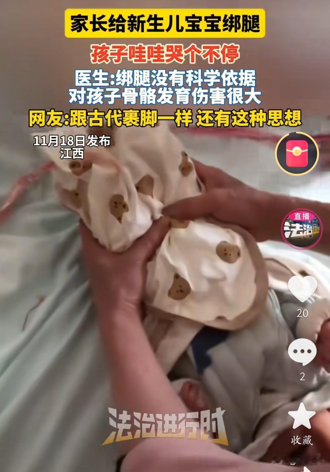 医生早明确说了：新生儿腿弯是正常生理弯曲，长大自然会直，绑腿反而会压迫骨骼、影响