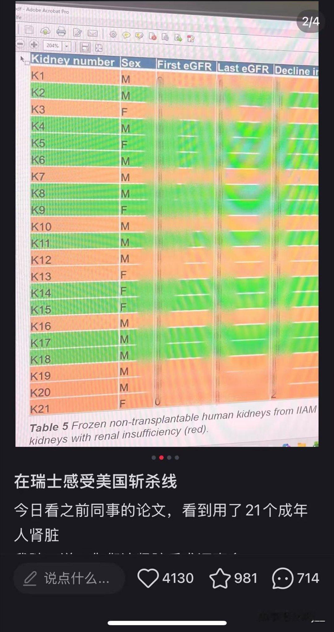 一位在瑞士就读的女性华人医学生在实验室里发现，团队用于研究的34个人体肾脏（包括