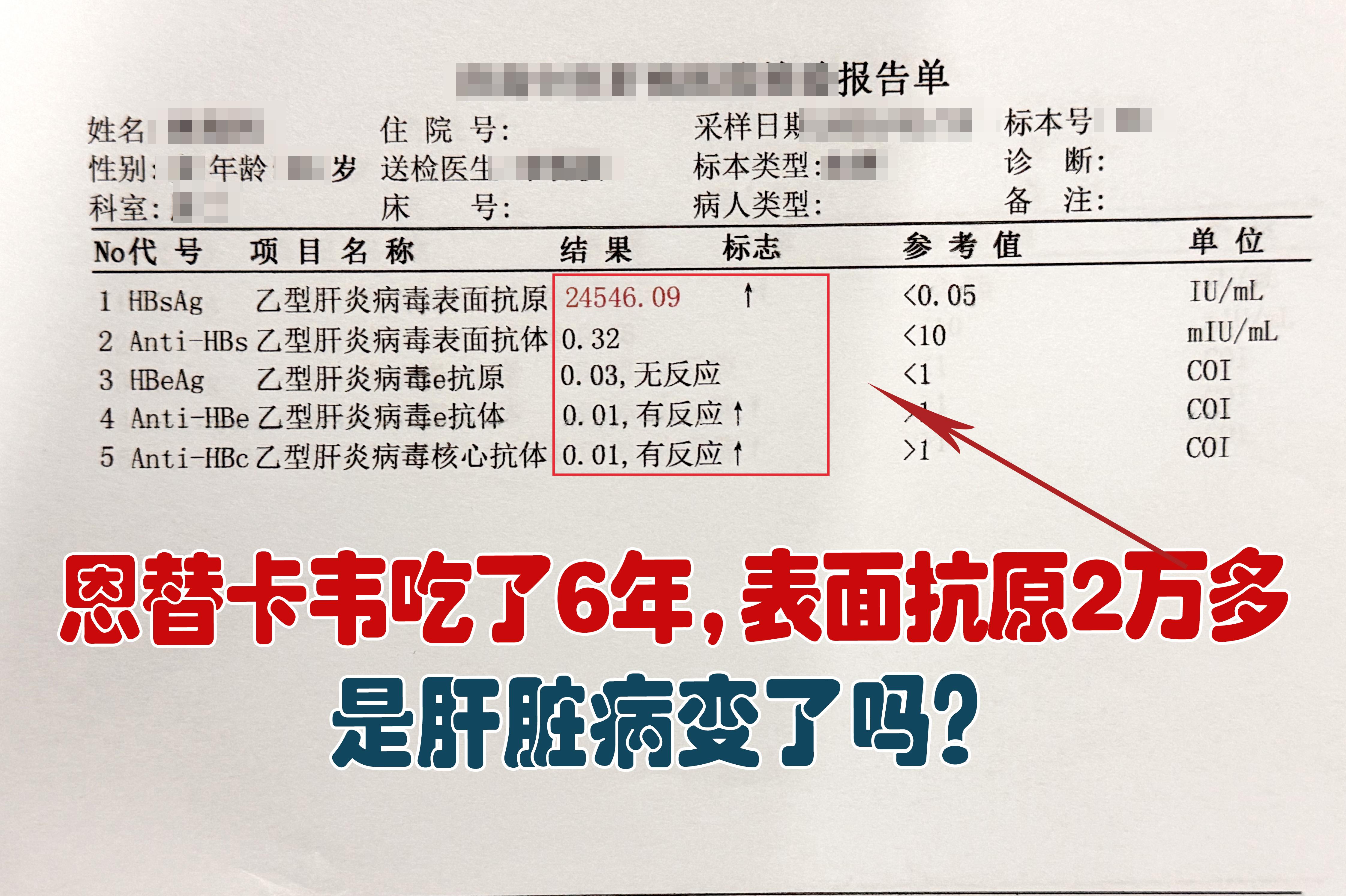 “吴医生，我吃恩替卡韦6年了，这次复查表面抗原还有2万多，病毒5.23...