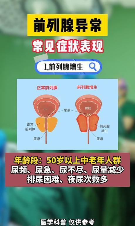前列腺异常的常见症状表现！