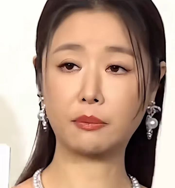 林心如这张脸到底怎么了，怎么变成这样子，整个就像一副苦瓜脸，甚至还有些浮肿，看起